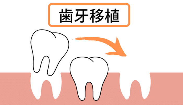 カウンセリング